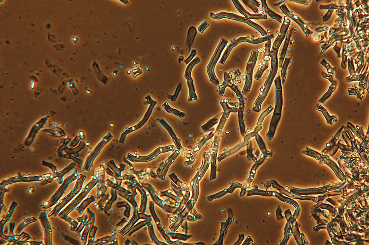 Crosta bianca da det. (Byssomerulius corium)